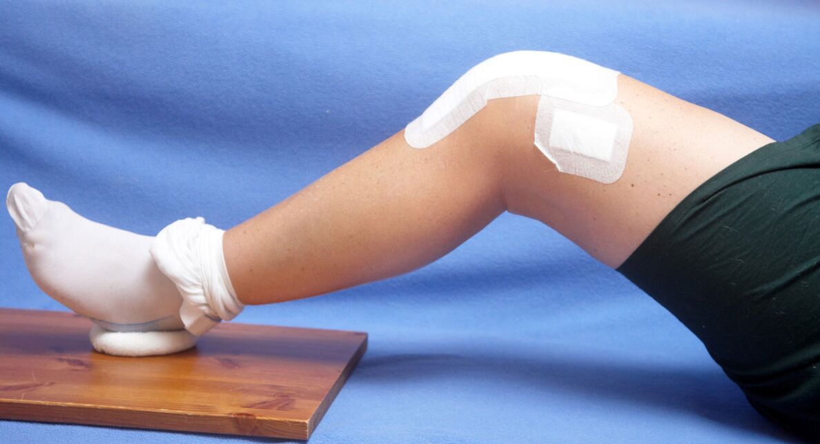 Arthrose der Kniegelenkbehandlung